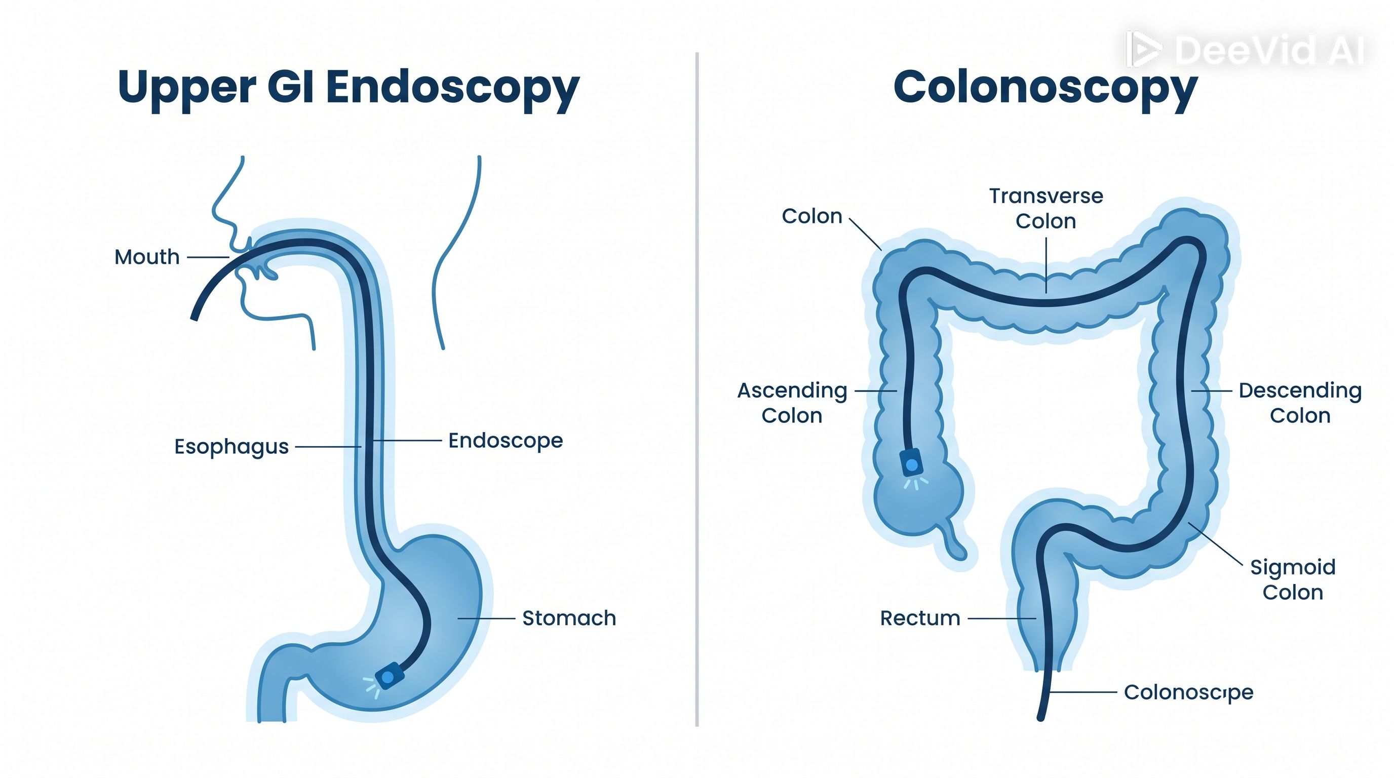 Diagnostic Endoscopy